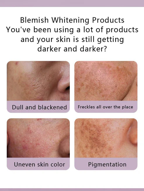 Dr. Rashel - Whitening Fade Spots Skin Care Mini Set (Original)